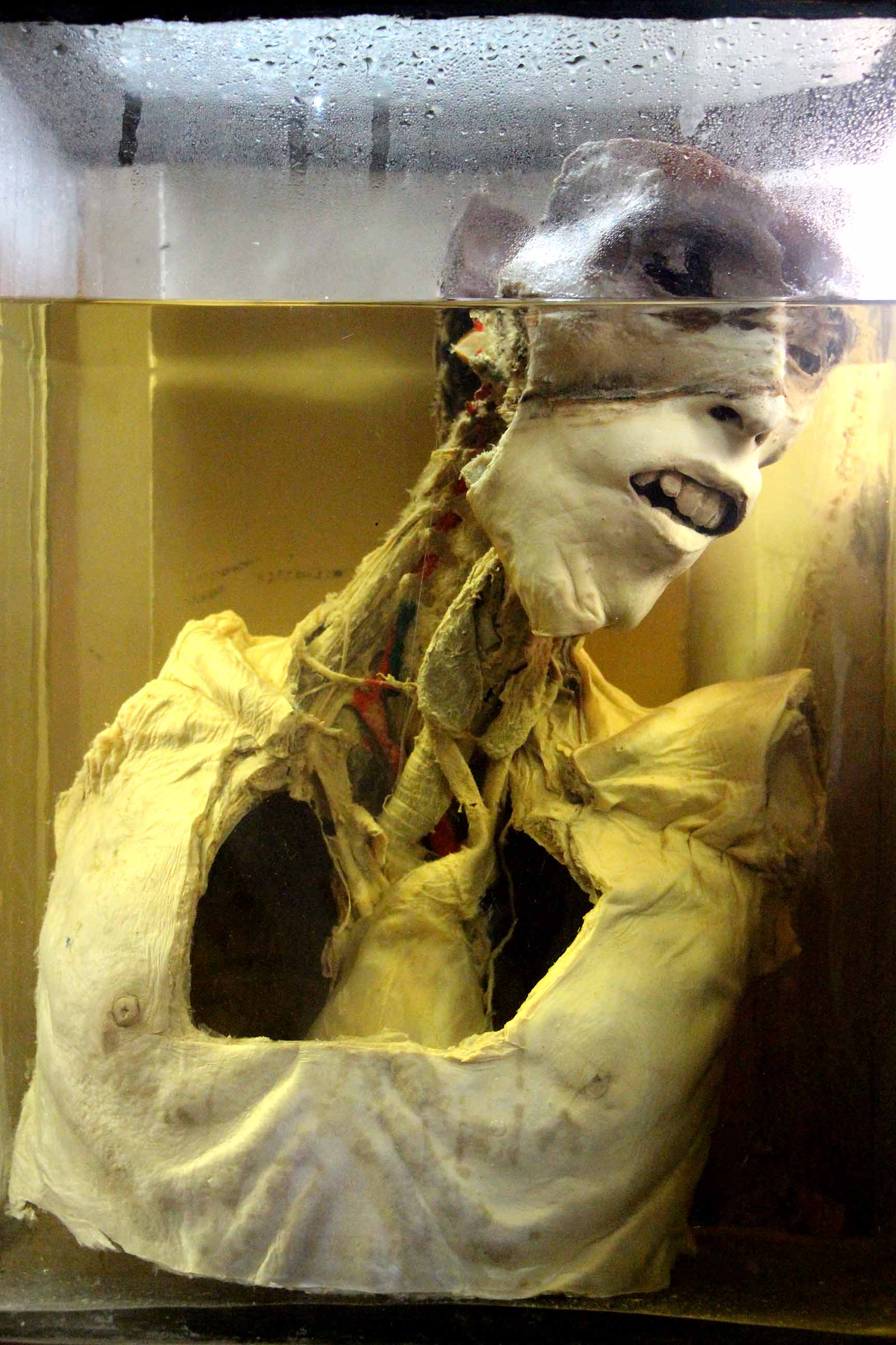 Anatomical display unit at Seth G.S Medical College, Anatomy Museum Anatomical display unit at Seth G.S Medical College, Anatomy Museum